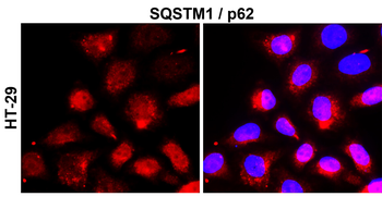 SQSTM1 Rabbit Polyclonal Antibody