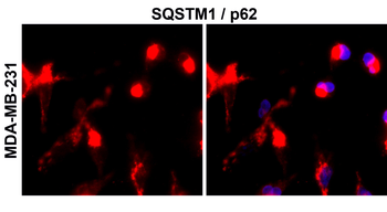 SQSTM1 Rabbit Polyclonal Antibody