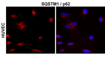 SQSTM1 Rabbit Polyclonal Antibody