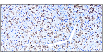 SQSTM1 Rabbit Polyclonal Antibody