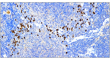 SQSTM1 Rabbit Polyclonal Antibody