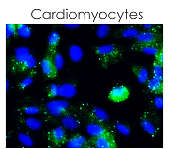 LC3B Rabbit Polyclonal Antibody