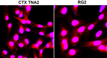 LC3B Rabbit Polyclonal Antibody