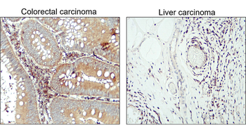 LC3B Rabbit Polyclonal Antibody