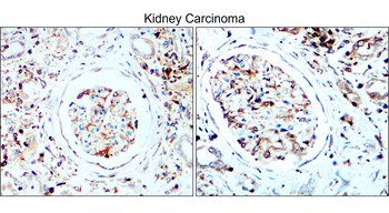 LC3B Rabbit Polyclonal Antibody