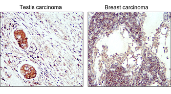 LC3B Rabbit Polyclonal Antibody