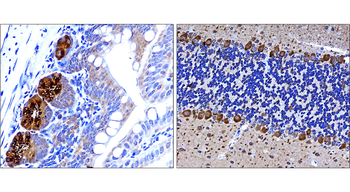 LC3B Rabbit Polyclonal Antibody