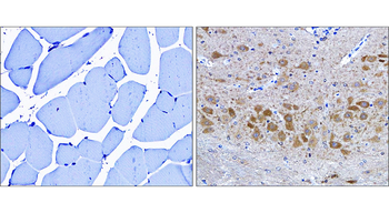 LC3B Rabbit Polyclonal Antibody