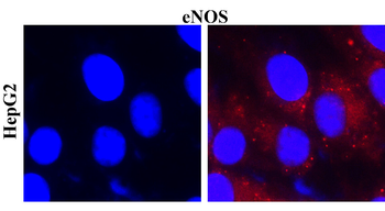 eNOS Rabbit Polyclonal Antibody