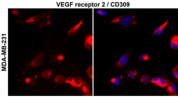 VEGFR2 Rabbit Polyclonal Antibody