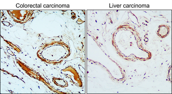 VEGFR2 Rabbit Polyclonal Antibody