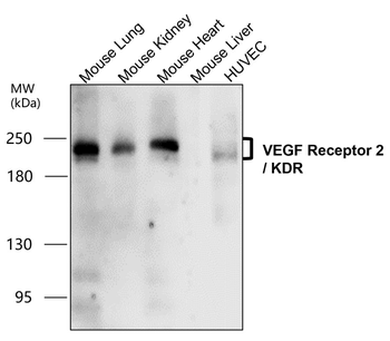 VEGFR2 Rabbit Polyclonal Antibody