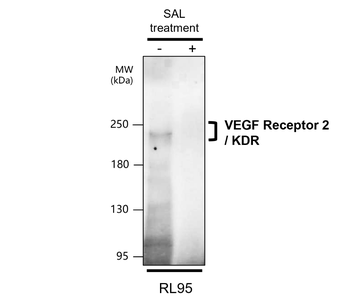 VEGFR2 Rabbit Polyclonal Antibody