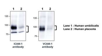 ICAM-1 Rabbit Polyclonal Antibody