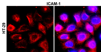 ICAM-1 Rabbit Polyclonal Antibody