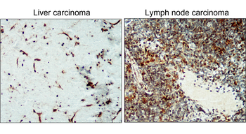 ICAM-1 Rabbit Polyclonal Antibody