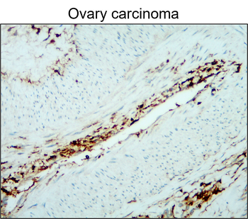 CD45 (Intracellular) Rabbit Polyclonal Antibody