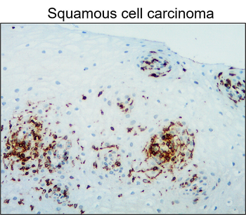 CD45 (Intracellular) Rabbit Polyclonal Antibody