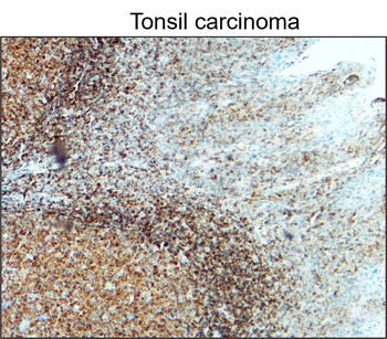 CD45 (Intracellular) Rabbit Polyclonal Antibody
