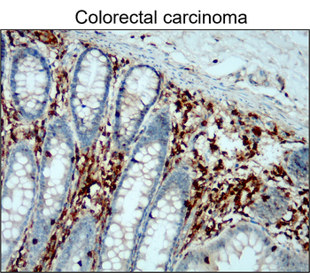 CD45 (Intracellular) Rabbit Polyclonal Antibody