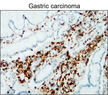 CD45 (Intracellular) Rabbit Polyclonal Antibody