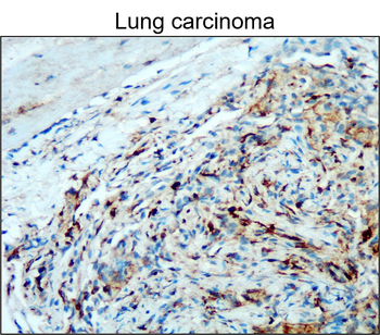 CD45 (Intracellular) Rabbit Polyclonal Antibody
