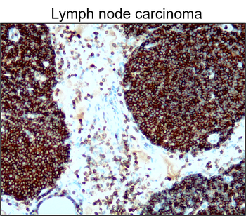 CD45 (Intracellular) Rabbit Polyclonal Antibody