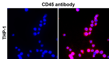 CD45 (Extracellular) Rabbit Polyclonal Antibody