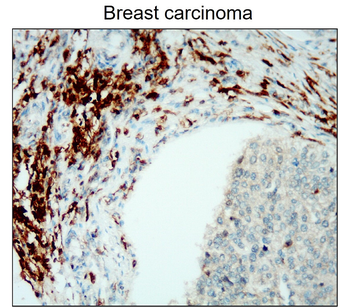 CD45 (Extracellular) Rabbit Polyclonal Antibody