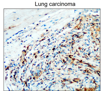 CD45 (Extracellular) Rabbit Polyclonal Antibody