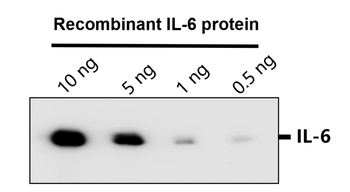 IL-6 Rabbit Polyclonal Antibody