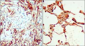 IL-6 Rabbit Polyclonal Antibody
