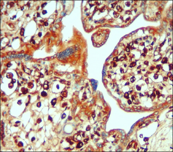 IL-6 Rabbit Polyclonal Antibody
