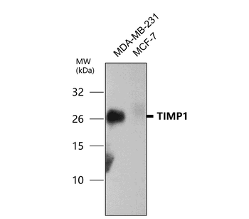 TIMP1 Rabbit Polyclonal Antibody