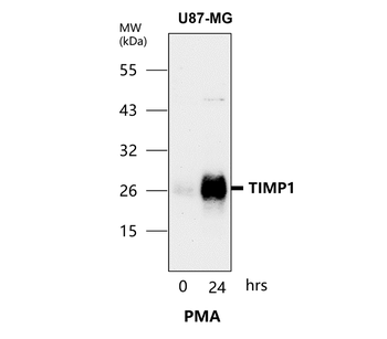 TIMP1 Rabbit Polyclonal Antibody
