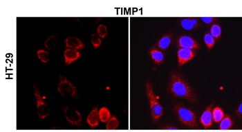 TIMP1 Rabbit Polyclonal Antibody