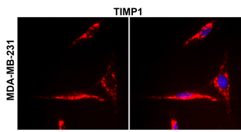 TIMP1 Rabbit Polyclonal Antibody