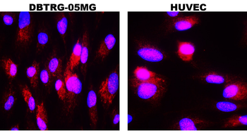 MMP9 Rabbit Polyclonal Antibody