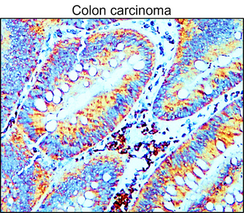 MMP9 Rabbit Polyclonal Antibody