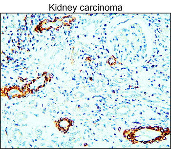 MMP9 Rabbit Polyclonal Antibody