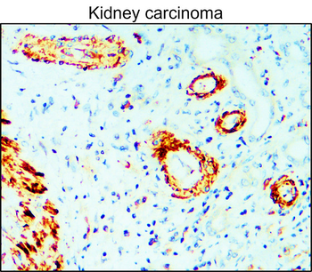 MMP9 Rabbit Polyclonal Antibody
