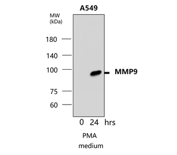 MMP9 Rabbit Polyclonal Antibody