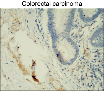 MMP2 Rabbit Polyclonal Antibody