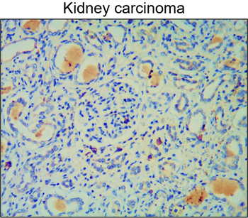 MMP2 Rabbit Polyclonal Antibody