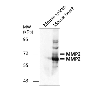 MMP2 Rabbit Polyclonal Antibody