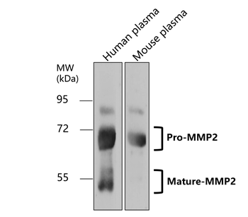 MMP2 Rabbit Polyclonal Antibody