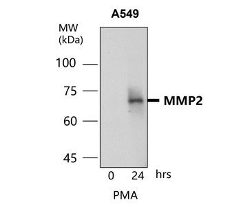 MMP2 Rabbit Polyclonal Antibody