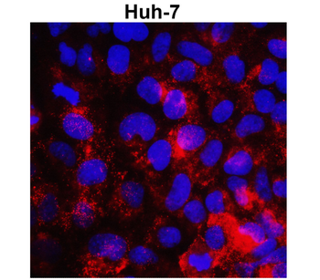 MMP1 Rabbit Polyclonal Antibody