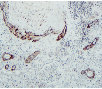 MMP1 Rabbit Polyclonal Antibody