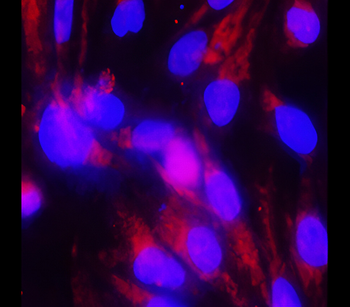 OCLN Rabbit Polyclonal Antibody